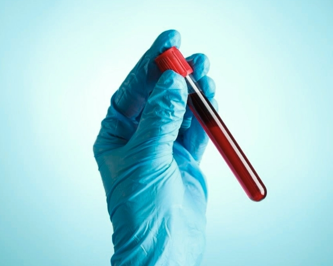 Abnormal PSA Results