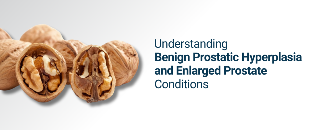 Understanding Benign Prostatic Hyperplasia and Enlarged Prostate Conditions