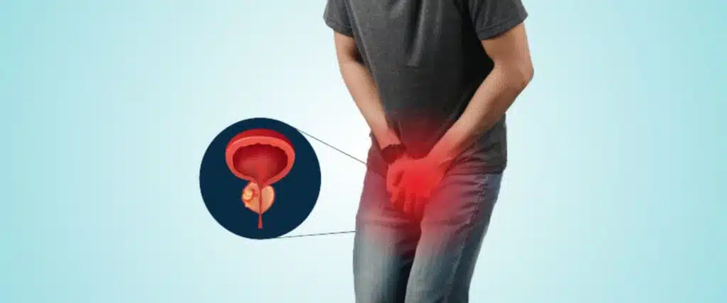 How Prostate Health Changes With Age