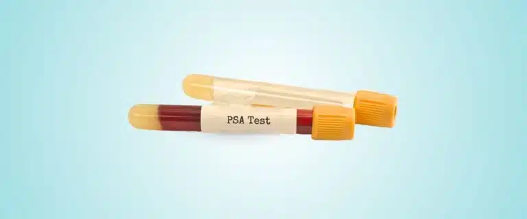 Understanding PSA Testing and Prostate Cancer Screening Methods