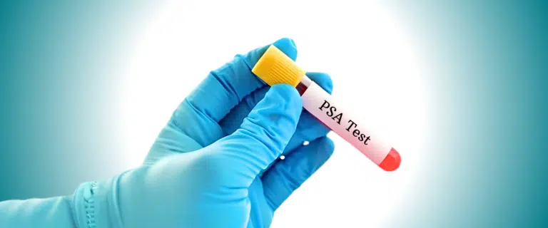Medical Tests Used to Evaluate Prostate Health
