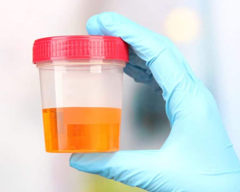 Blood Detected In Urine