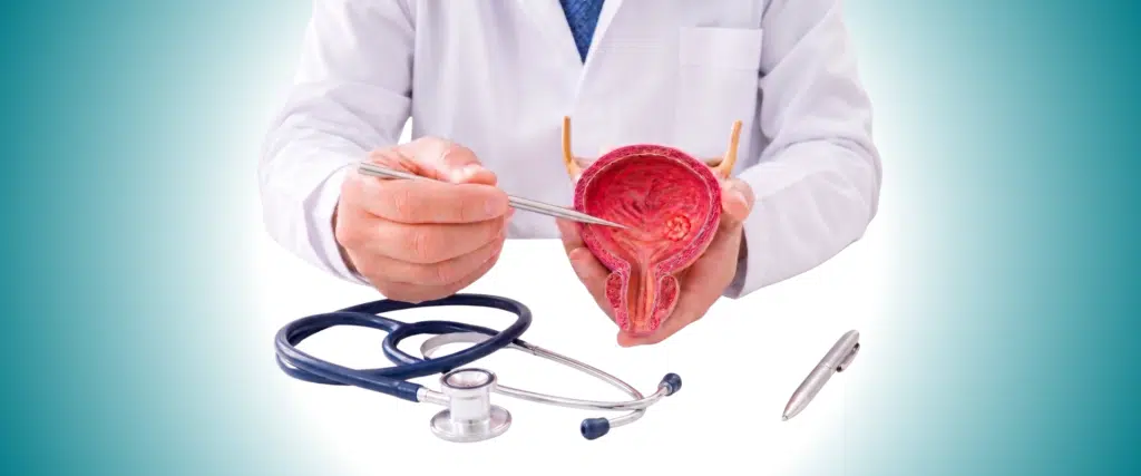 Bladder Cancer: A Complete Patient Guide to Symptoms and Treatment