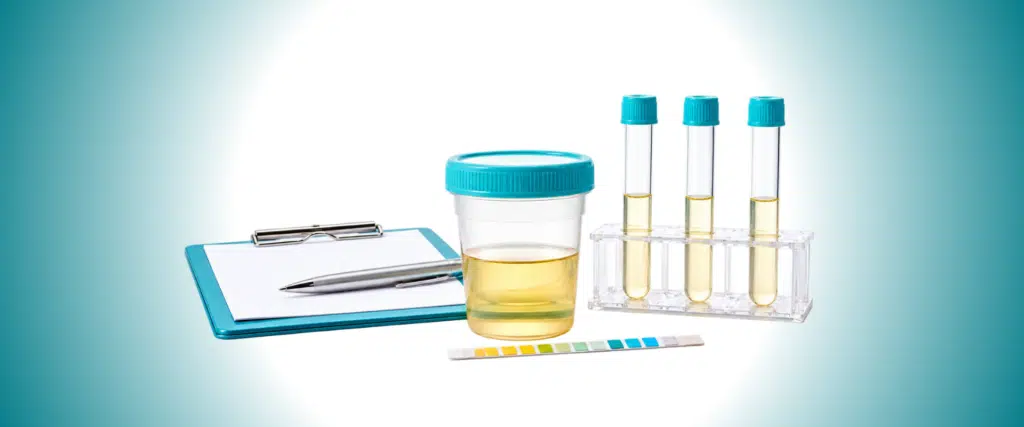 Urinary Tract Infections - Causes, Treatment, and Prevention Guide
